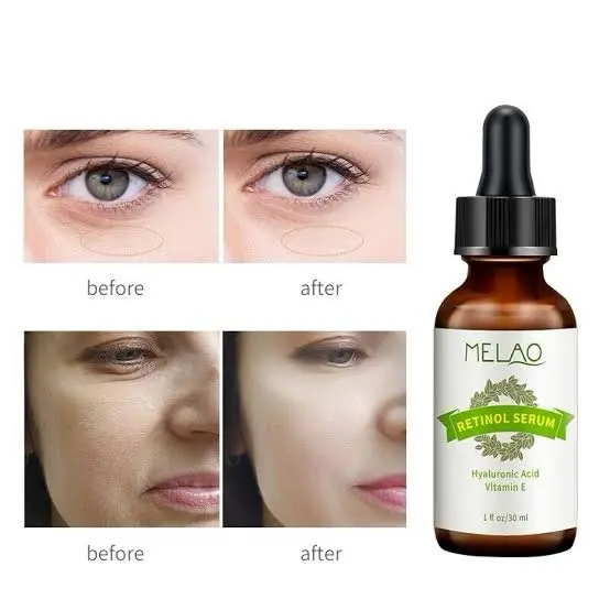 Picture of MELAO Retinol Hyaluronic Acid Vitamin E Serum 30ml