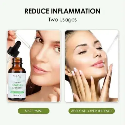 Picture of Melao Tea Tree Clear Skin Serum – 30 ml