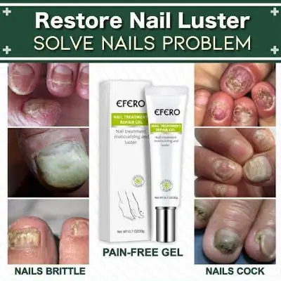 Picture of Efero Nail Repair Treatment Gel Fungus Cream-20gm