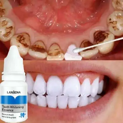Picture of Lanbena Teeth Whitening Essence 10ml