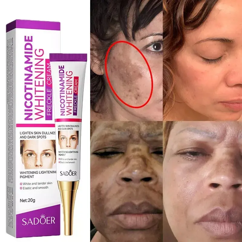Picture of SADOER Whitening and Freckle Removal Cream Moisturizing Moisturizing and Fading Niacinamide Cream-20gm