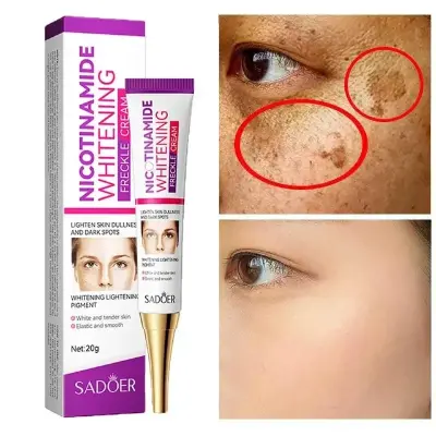 Picture of SADOER Whitening and Freckle Removal Cream Moisturizing Moisturizing and Fading Niacinamide Cream-20gm