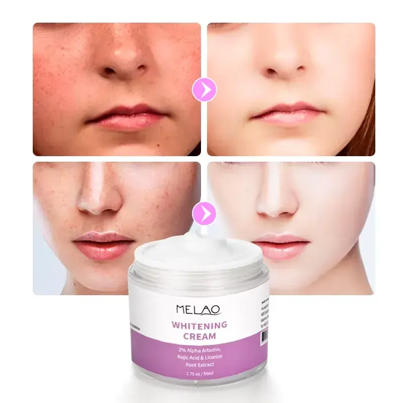 Picture of Melao 2% Alpha Arbutin, Kojiac Acid Whitening Cream -50 ml