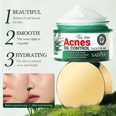 Picture of SADOER Facial Cream Acne Care Moisturizing Tea Tree Oil Acne Pimple Scar Removal Anti Acne for Face Skin Care - 50g