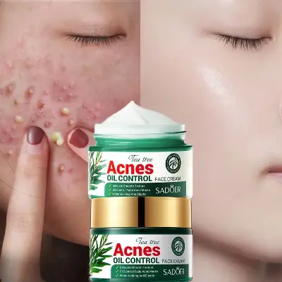 Picture of SADOER Facial Cream Acne Care Moisturizing Tea Tree Oil Acne Pimple Scar Removal Anti Acne for Face Skin Care - 50g