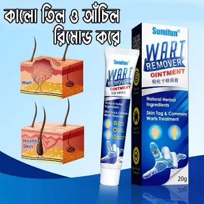 Picture of Wart Remover Ointment 20gm