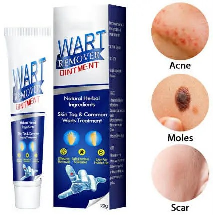 Picture of Wart Remover Ointment 20gm