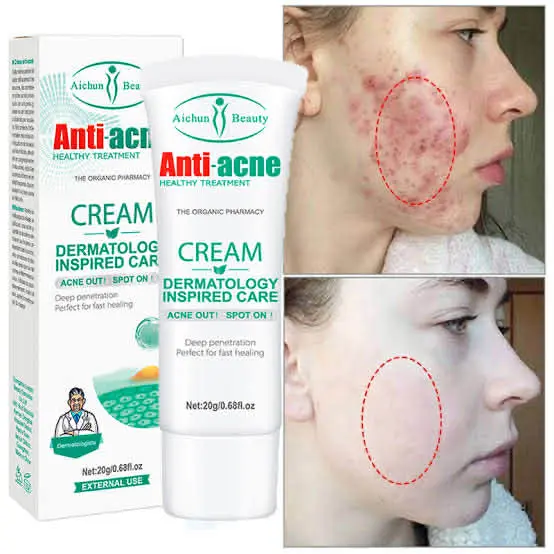 Picture of AICHUN BEAUTY Anti-Acne Cream Treats Pimple Clogged Pores Oil Control Reduces Acne Scars Shrinks Pores 20g / 0.68fl.oz