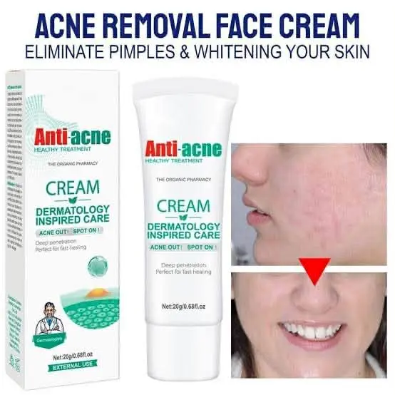Picture of AICHUN BEAUTY Anti-Acne Cream Treats Pimple Clogged Pores Oil Control Reduces Acne Scars Shrinks Pores 20g / 0.68fl.oz