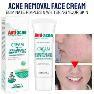 Picture of AICHUN BEAUTY Anti-Acne Cream Treats Pimple Clogged Pores Oil Control Reduces Acne Scars Shrinks Pores 20g / 0.68fl.oz