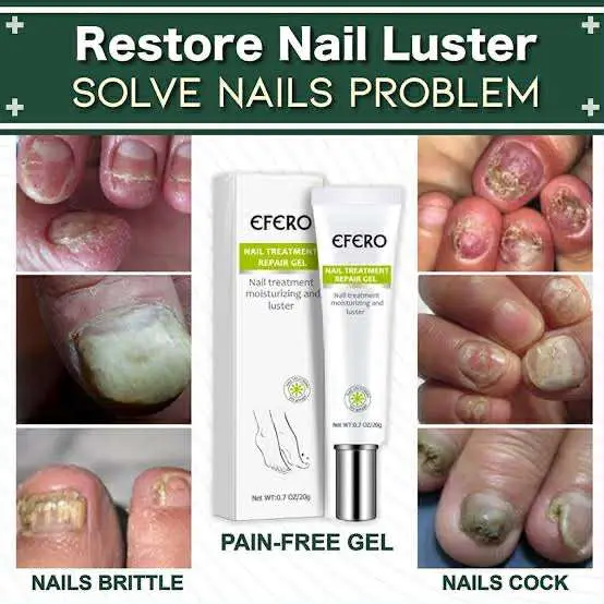 Picture of Efero Nail Repair Treatment Gel Fungus Cream-20gm (Next lavel cosmic)