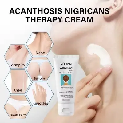 Picture of Skin Mooyam Whitening Cream Acanthosis Nigricans Remove Black Patches Dark Spot Corrector Knee Elbow Underarm Neck Lightening Cream