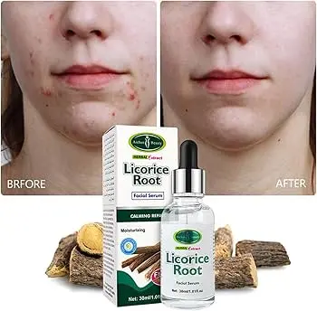 Picture of Aichun Beauty Licorice Root AntiInflammatory Facial Serum 30ml