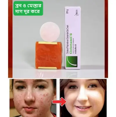 Picture of Clobetamil G Anti Freckles and Skin Whitening Cream 3in1 Set