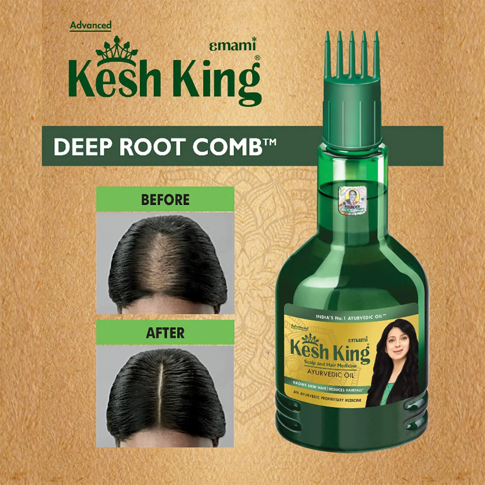 Picture of KeshKing Anti-Hairfall Aloe Vera Shampoo 200ml(Green)