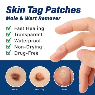 Picture of Wart Remover Ointment 20g(Blue,Body)