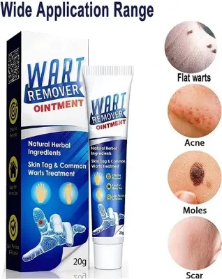 Picture of Wart Remover Ointment 20gm(Blue,Body)