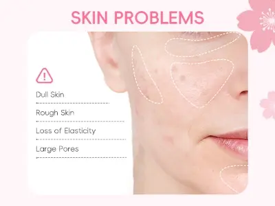 Picture of LAIKOU Sakura Skincare Set 4pcs (Face Cleanser /Toner/ Lotion/ Face Cream) - 2gm (5×4 pcs) 20 pcs (Pink)