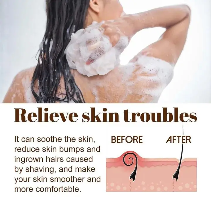 Picture of Davey Black Soape - 100gm Oily Control Acne care Deep Cleaning (Fresh)