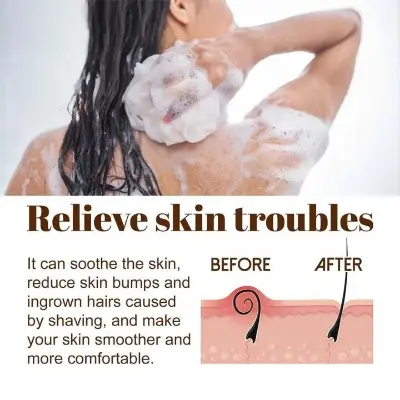 Picture of Davey Black Soape - 100gm Oily Control Acne care Deep Cleaning (Fresh)