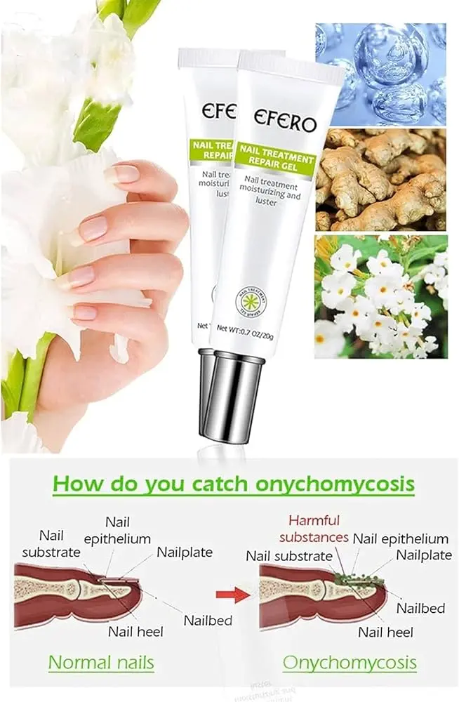 Picture of Efero Nail Repair Treatment Gel Fungus Cream-20gm 