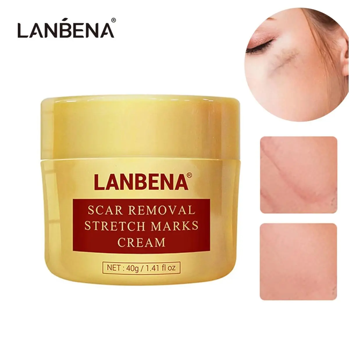 Picture of LANBENA Scar Removal Cream 40g 