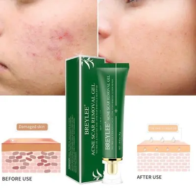 Picture of Breylee Acne & Scar Removal Gel - 30g 