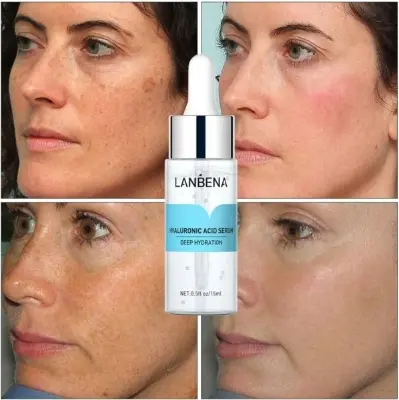 Picture of Lanbena Hyaluronic Acid Serum 15ml 