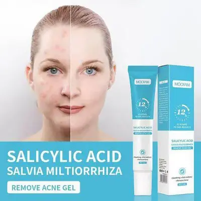 Picture of MOOYAM Salicylic Acid Remove Acne Gel For Stubborn Acne Pimple-20gm