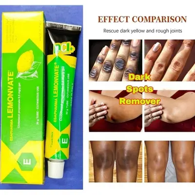 Picture of Lemonvate Cream - 30gm (Italy)