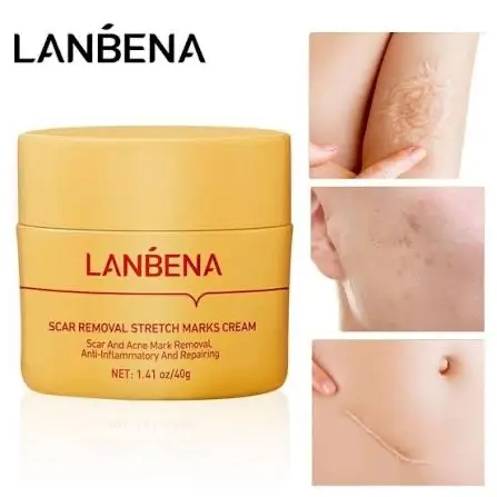 Picture of LANBENA Acne Scar Removal Cream Repair Acne Spots Acne Treatment Blackhead Whitening Shrink Pores Stretch Marks Skin Care 40g