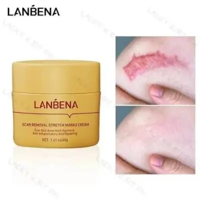 Picture of LANBENA Acne Scar Removal Cream Repair Acne Spots Acne Treatment Blackhead Whitening Shrink Pores Stretch Marks Skin Care 40g