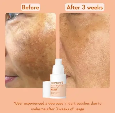 Picture of Wishcare Super Bright C16 Vitamin C Face Serum - 30 ml