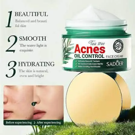 Picture of SADOER Facial Cream Acne Care Moisturizing Tea Tree Oil Acne Pimple Scar Removal Anti Acne for Face Skin Care - 50g