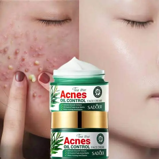Picture of SADOER Facial Cream Acne Care Moisturizing Tea Tree Oil Acne Pimple Scar Removal Anti Acne for Face Skin Care - 50g