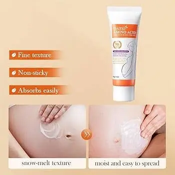 Picture of SADOER Oats & Amino Acid Stretch Mark Cream 40gm For Pregnancy Repair Scar, Hydrates and Soothes & Reduces Stretch Marks