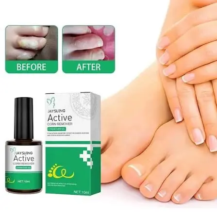 Picture of Jaysuing Active Corn Remover Gel – 10ml Strong Formula for Effective Callus and Corn Removal