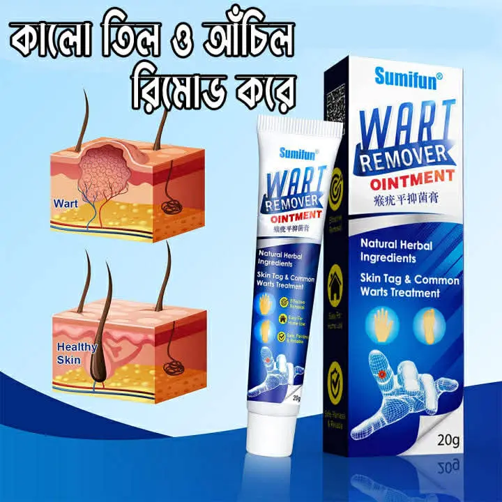 Picture of Wart Remover Ointment 20gm