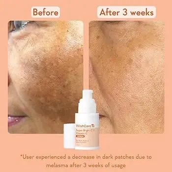 Picture of Wishcare Super Bright C16 Vitamin C Face Serum - 30 ml