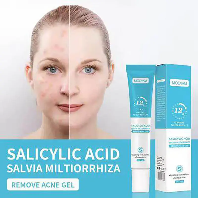 Picture of MOOYAM Salicylic Acid Remove Acne Gel For Stubborn Acne Pimple-20gm
