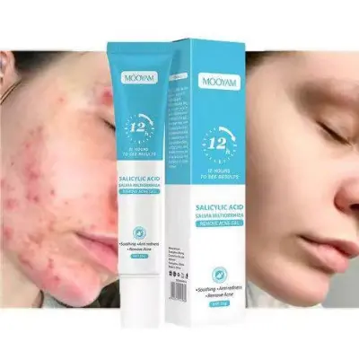Picture of MOOYAM Salicylic Acid Remove Acne Gel For Stubborn Acne Pimple-20gm