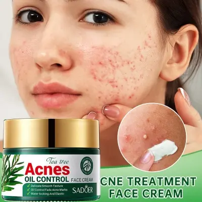 Picture of SADOER Facial Cream Acne Care Moisturizing Tea Tree Oil Acne Pimple Scar Removal Anti Acne for Face Skin Care - 50g
