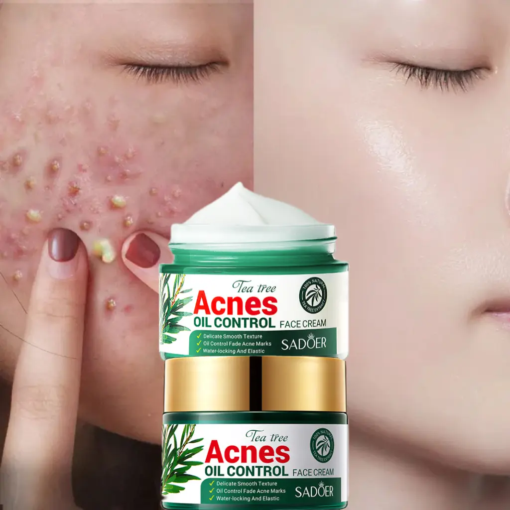 Picture of SADOER Facial Cream Acne Care Moisturizing Tea Tree Oil Acne Pimple Scar Removal Anti Acne for Face Skin Care - 50g