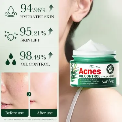 Picture of SADOER Facial Cream Acne Care Moisturizing Tea Tree Oil Acne Pimple Scar Removal Anti Acne for Face Skin Care - 50g
