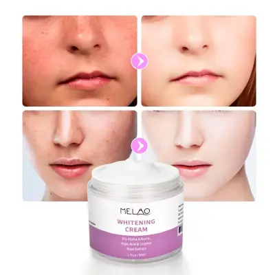 Picture of Melao 2% Alpha Arbutin, Kojiac Acid Whitening Cream -50 ml