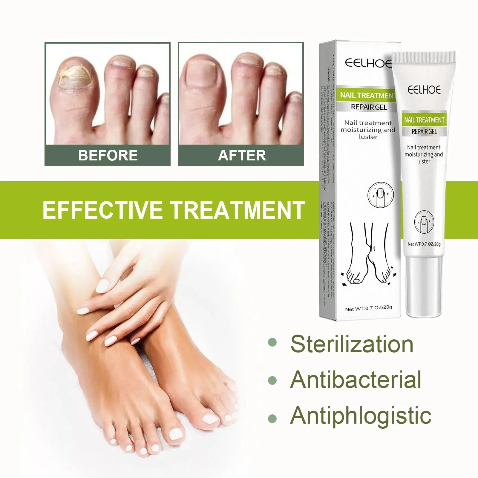 Picture of EELHOE Nail Fungus Repair Essence Gel Nail Treatment Repair Cream Gel-20gm