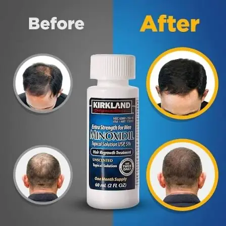 Picture of Kirkland Minoxidil 5% For Beard & Hair Growth