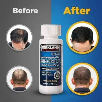 Picture of Kirkland Minoxidil 5% For Beard & Hair Growth