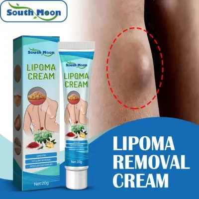 Picture of South Moon Lipoma Removal Cream Lipolysis Fat Lump Relieve Plaster Skin Swelling Ointment Subcutaneous Lumps Dredge Dissipate Body Care（20g）