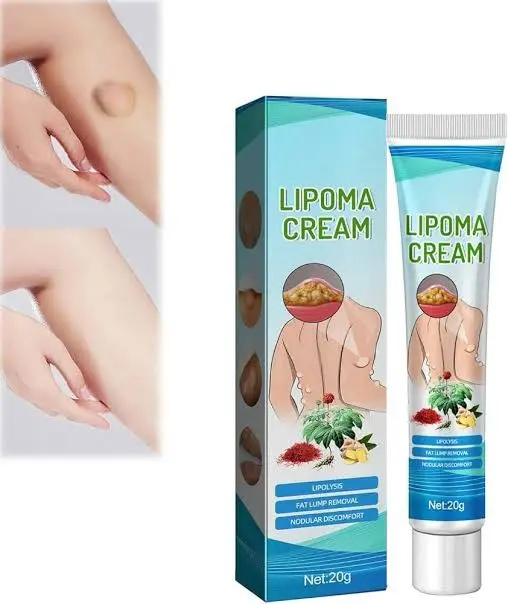 Picture of South Moon Lipoma Removal Cream Lipolysis Fat Lump Relieve Plaster Skin Swelling Ointment Subcutaneous Lumps Dredge Dissipate Body Care（20g）